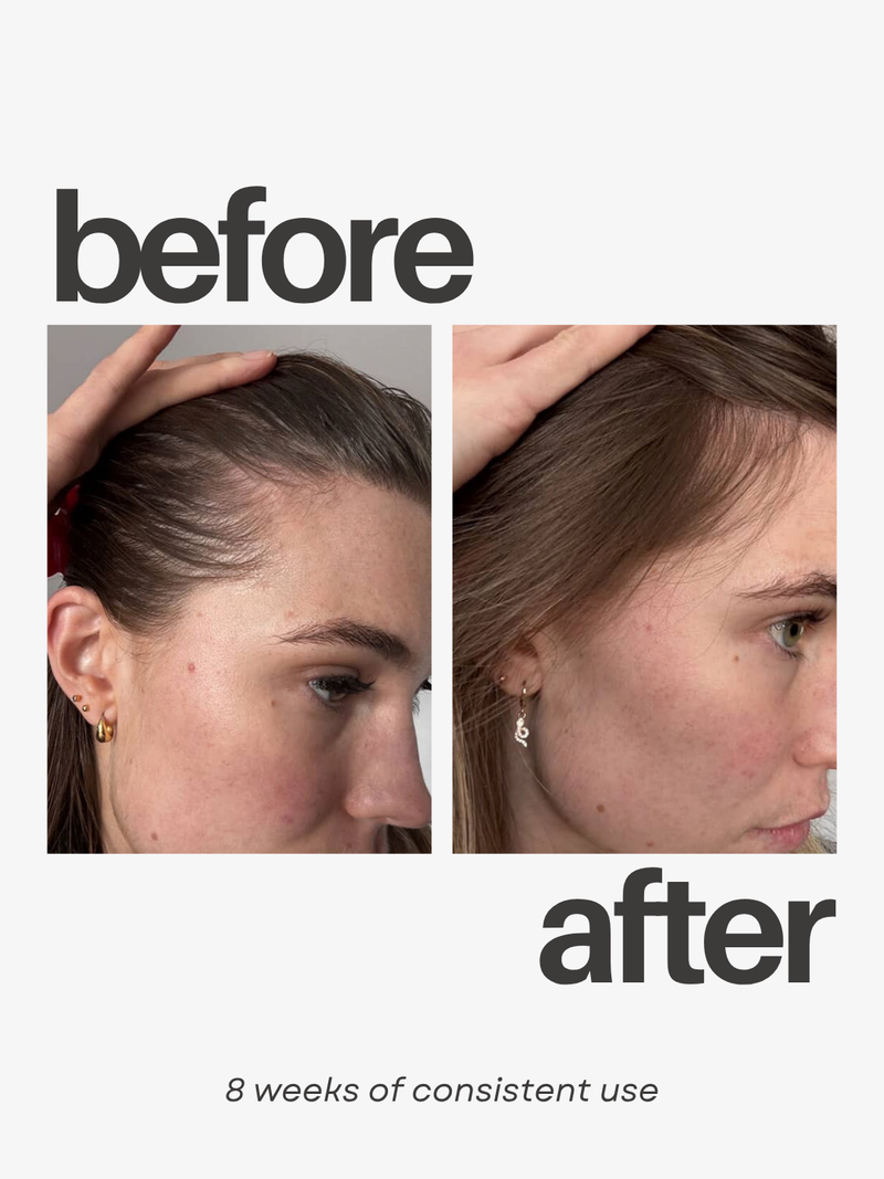 SO'L THIC THICKENING SERUM WITH SPF15